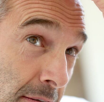 Comment prévenir la chute de cheveux chez les hommes ?